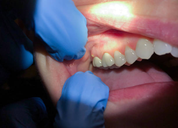 Best Emergency Gum Pain Relief  in North Patchogue, NY